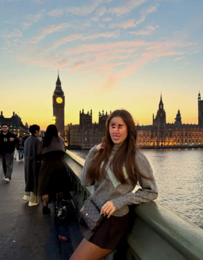 Chloe Amelie