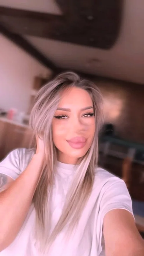 Erica